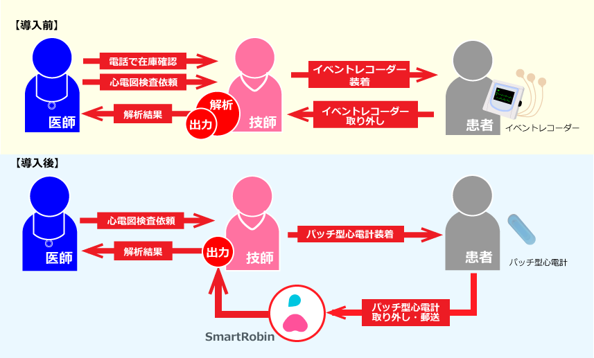 心電図検査、導入前／導入後